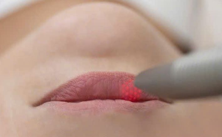 Glamour Lip Treatment