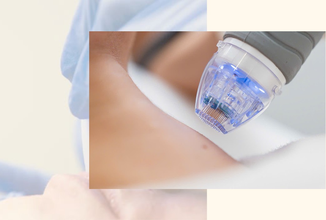 Skin Longevity Treatment